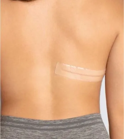 Amoena CuraScar Strips